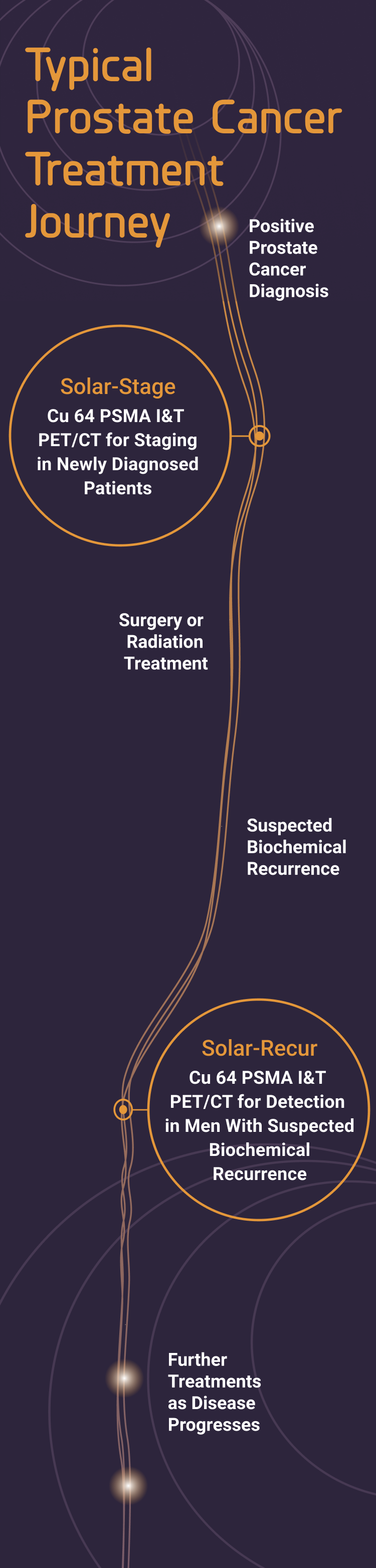 Typical prostate cancer treatment journey
