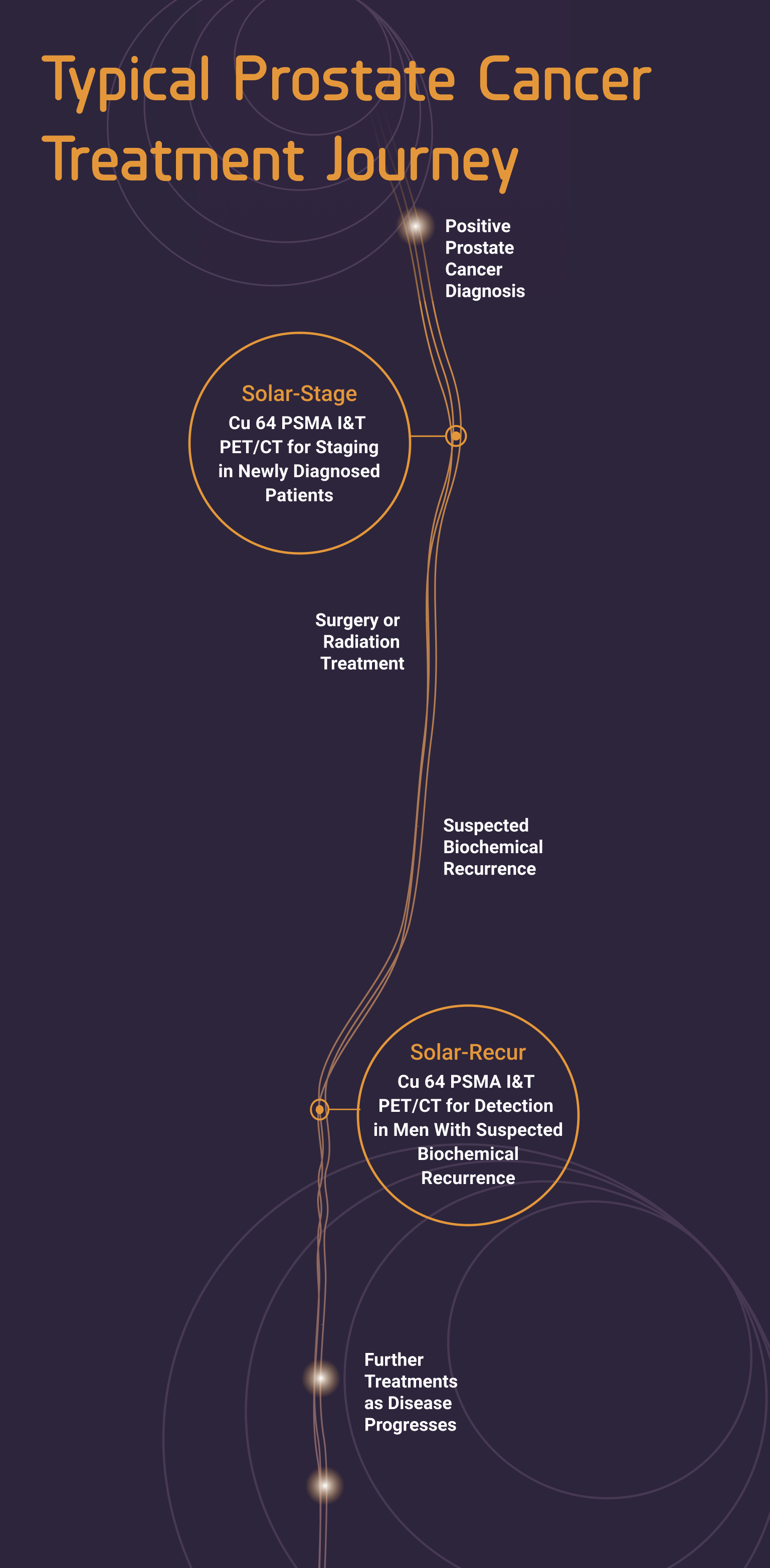 Typical prostate cancer treatment journey