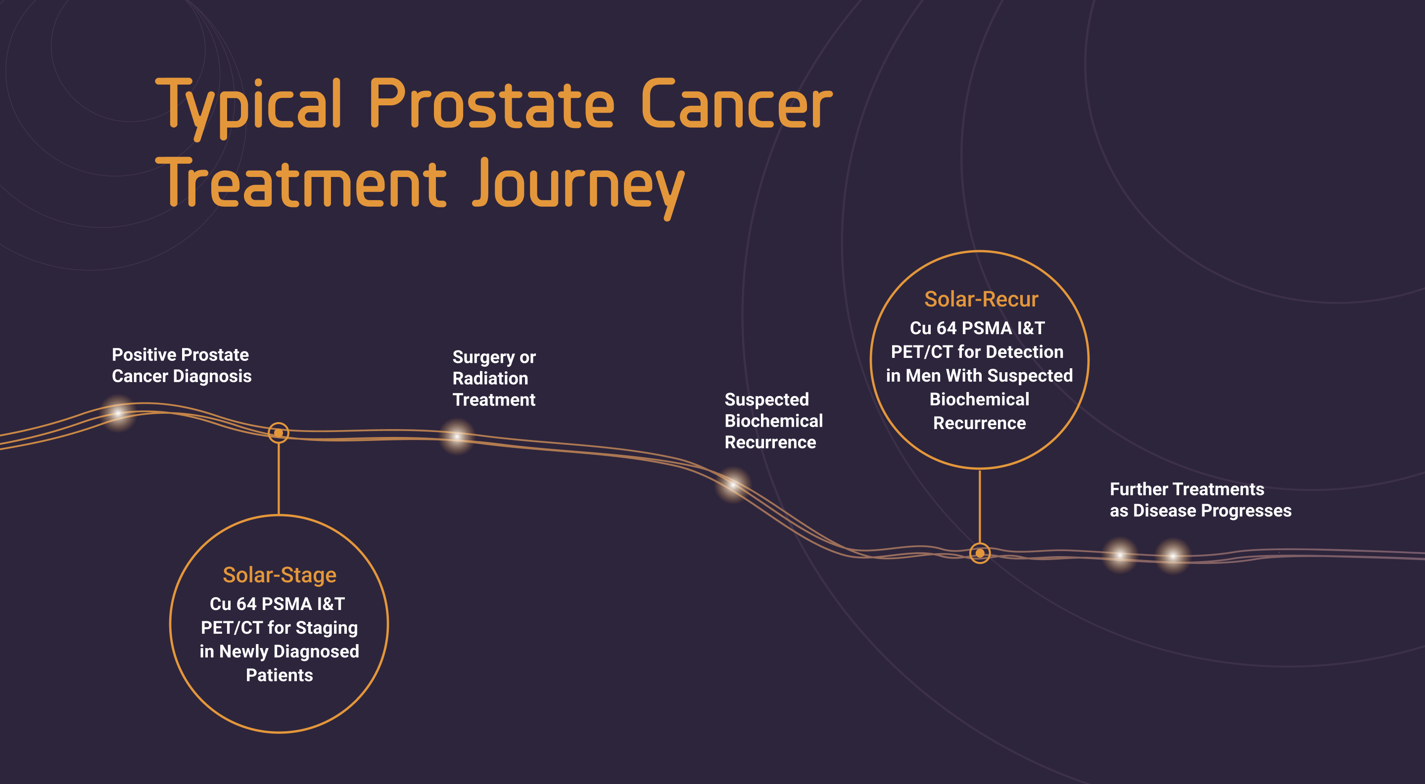 Typical prostate cancer treatment journey